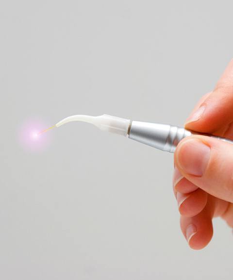 Hand holding laser peri implantitis treatment tool