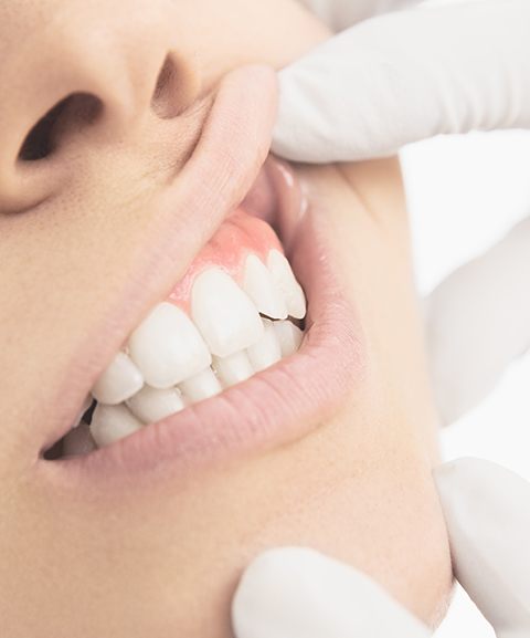 Periodontist performing oral cancer screening