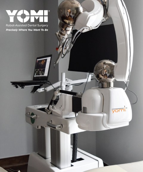 Yomi robot assisted dental implant surgery system